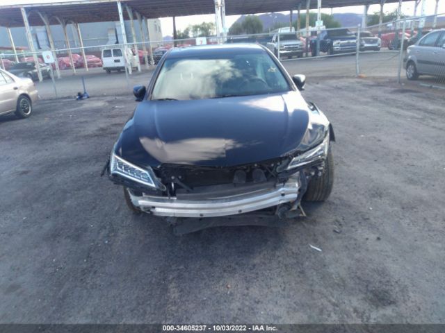 19UUB2F31HA004865 Acura Tlx V6