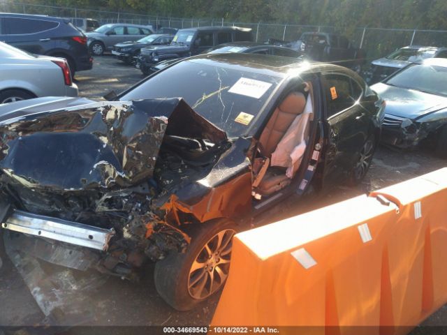 19UUB1F51FA004518 Acura TLX TECH