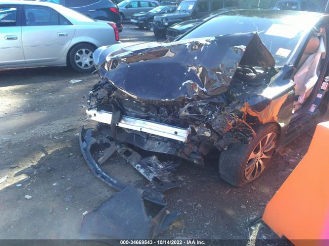 19UUB1F51FA004518 Acura TLX TECH