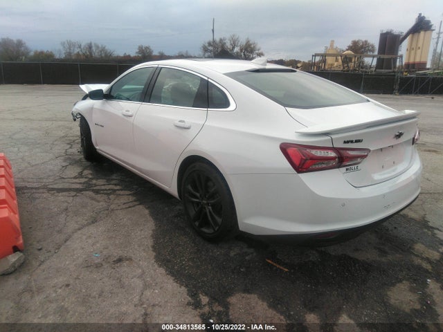 Chevrolet MALIBU LT 2021 1G1ZD5ST4MF088126 Image 3