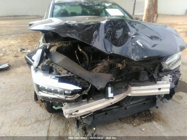 Acura TLX 2020 19UUB1F31LA004464 Image 6