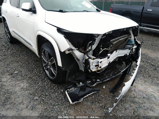 GMC Acadia Denali 2017 1GKKNXLS6HZ141294 Image 6