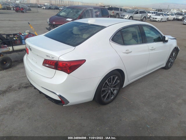 Acura TLX 2019 19UUB2F3XKA003172 Image 5
