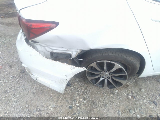 Acura TLX 2017 19UUB1F34HA010783 Image 6