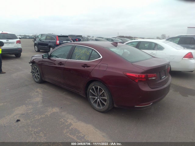 Acura Tlx V6 Advance 2016 19UUB2F74GA000651 Image 3