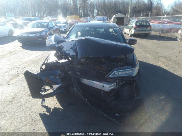 19UUB2F52FA002931 Acura Tlx V6 Tech