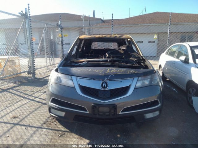 2HNYD2H62CH542738 Acura Mdx Advance Pkg