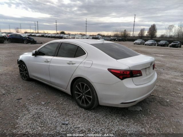19UUB2F56HA001509 Acura Tlx V6 W/technology Pkg