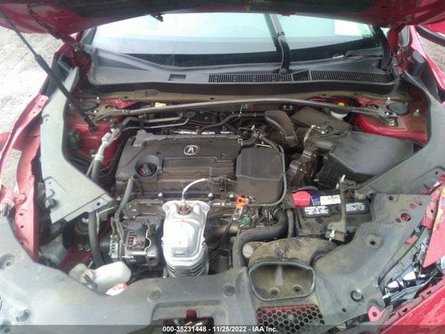 Acura TLX 2017 19UUB1F51HA000245 Image 10