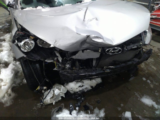 Hyundai VELOSTER 2016 KMHTC6AD2GU277966 Image 7