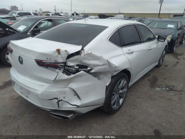 19UUB5F4XMA008093 Acura Tlx W/technology Package