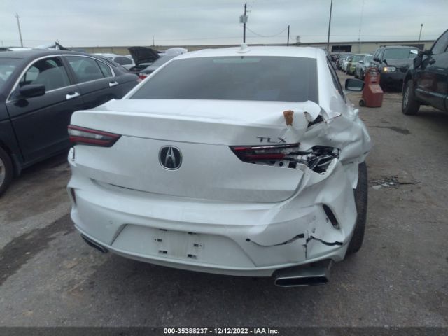 19UUB5F4XMA008093 Acura Tlx W/technology Package