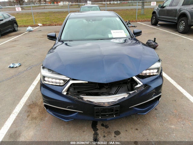 19UUB1F53LA015676 Acura TLX
