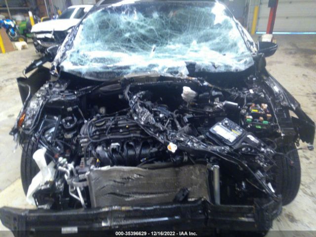 KNAFK5A81H5704693 KIA FORTE5