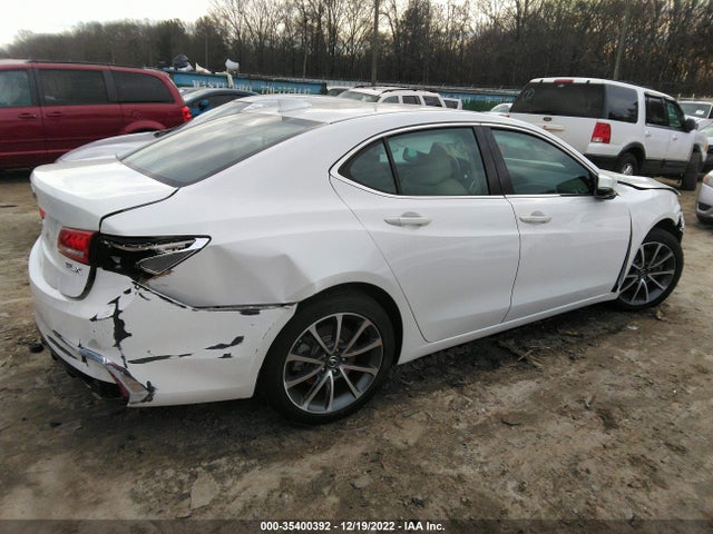 Acura TLX 2019 19UUB2F33KA001621 Image 4