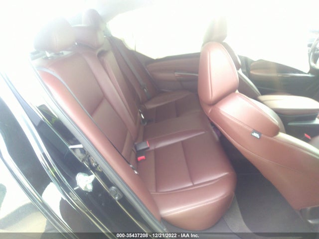Acura TLX 2017 19UUB1F31HA008540 Image 13