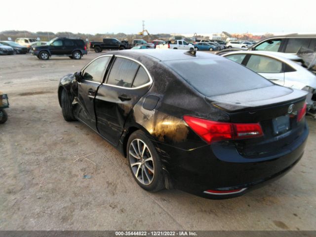 19UUB2F5XFA011084 Acura Tlx V6 Tech