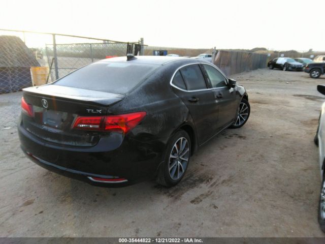 19UUB2F5XFA011084 Acura Tlx V6 Tech