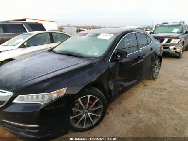 19UUB2F5XFA011084 Acura Tlx V6 Tech