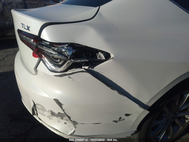 Acura TLX 2021 19UUB5F31MA006286 Image 4