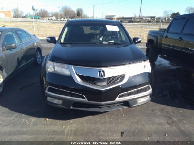 2HNYD2H55BH511019 Acura Mdx Advance Pkg