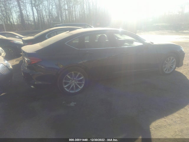 Acura TLX 2021 19UUB6F39MA005943 Image 5