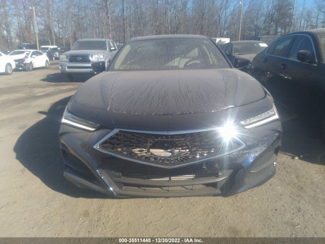 Acura TLX 2021 19UUB6F39MA005943 Image 7