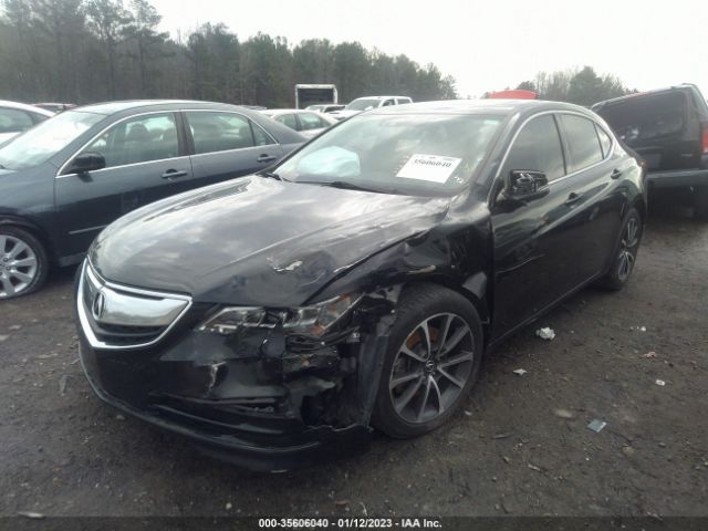 19UUB2F52FA019874 Acura Tlx V6 Tech