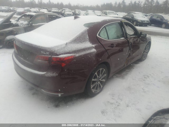 Acura Tlx V6 Tech 2016 19UUB2F58GA002031 Image 4