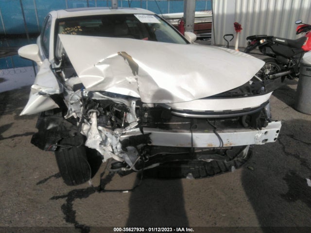 2018 Lexus ES, VIN: JTHBW1GG4J2177946