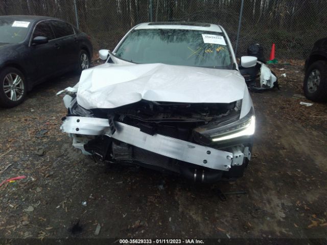 19UDE2F72LA000648 Acura Ilx Pkg