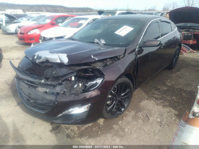 Chevrolet MALIBU LT 2021 1G1ZD5ST3MF016852 Image 2