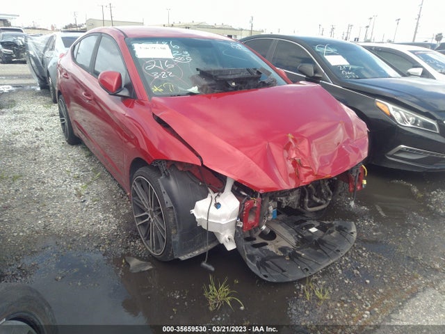 Hyundai ELANTRA SE 2017 KMHD84LF3HU062140 Image 1