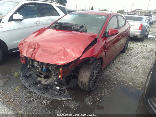 Hyundai ELANTRA SE 2017 KMHD84LF3HU062140 Image 2