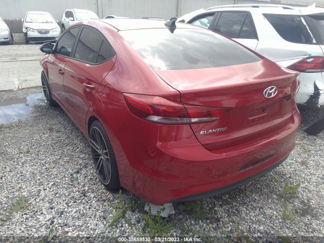 Hyundai ELANTRA SE 2017 KMHD84LF3HU062140 Image 3
