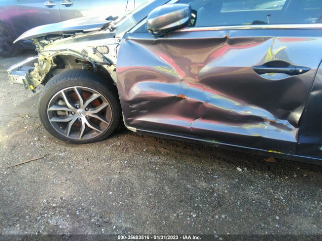 19UDE2F75LA012776 Acura Ilx Pkg