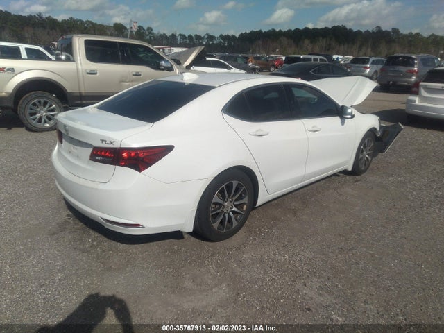 Acura Tlx W/technology Pkg 2017 19UUB1F55HA005125 Image 4