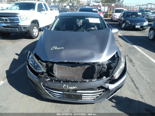 Hyundai ELANTRA SE 2017 KMHD74LF9HU082153 Image 7