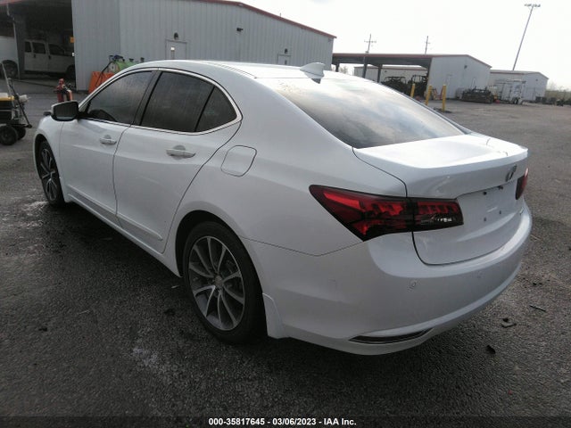 Acura Tlx V6 Advance 2015 19UUB3F79FA009639 Image 3