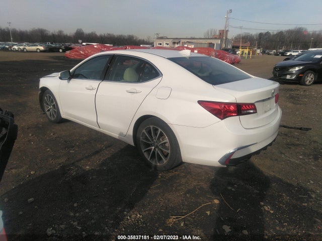 Acura TLX 2020 19UUB3F36LA001510 Image 3
