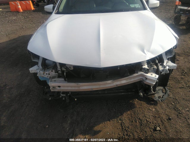 Acura TLX 2020 19UUB3F36LA001510 Image 6