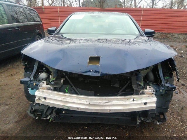 Acura TLX 2020 19UUB1F34LA012560 Image 7