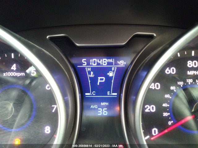 2017 Hyundai Veloster, VIN: KMHTC6AD6HU319914