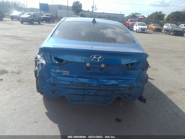 Hyundai ELANTRA SE 2017 KMHD74LF0HU124127 Image 7