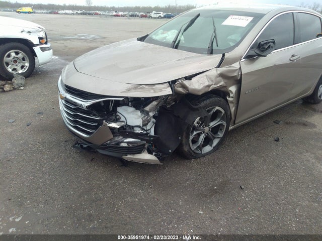 Chevrolet MALIBU LT 2022 1G1ZD5ST5NF199429 Image 6