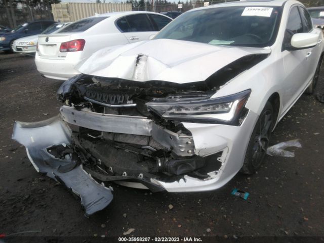 19UDE2F70LA009851 Acura Ilx Pkg