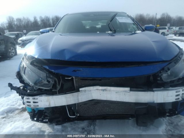 2HGFC2F65LH596992 Honda Civic Sedan Lx