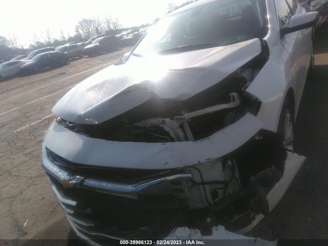 Chevrolet MALIBU LT 2021 1G1ZD5ST9MF068406 Image 6