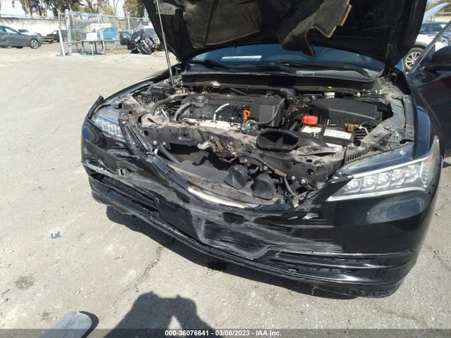 Acura TLX 2017 19UUB1F32HA003623 Image 7