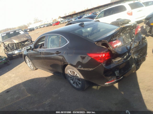 Acura TLX 2020 19UUB1F32LA013304 Image 3